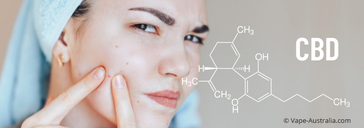 CBD for Acne: The Secret to Clear Skin - 2020 | Vape Australia